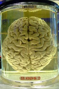 Cerebro