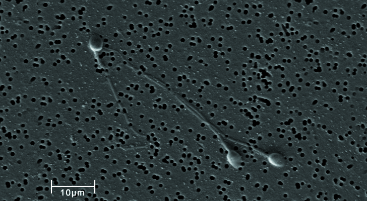 Imagen de microscopio digital de espermatozoides / Foto: Wikimedia Commons