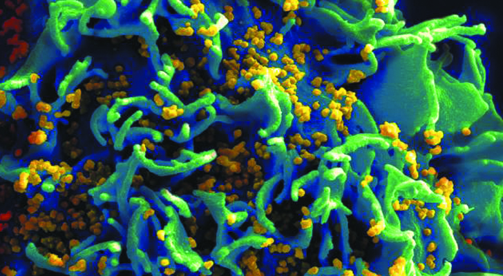 imagen tridimensional de una célula infectada de VIH / Foto: NIAID