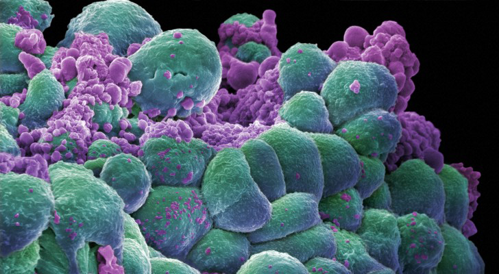 Imagen 3D de una célula con cáncer de mama Imagen 3D de una célula con cáncer de mama, uno de los tipos de cáncer analizados en el estudio / Foto: Annie Cavanagh. Wellcome Images