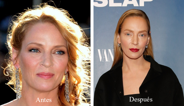 Uma Thurman Antes y Después de la Operación / Foto: AFP & Wikimedia Commons Thurman dejó al mundo estupefacto con su nueva imagen, resultado de cirugías plásticas.