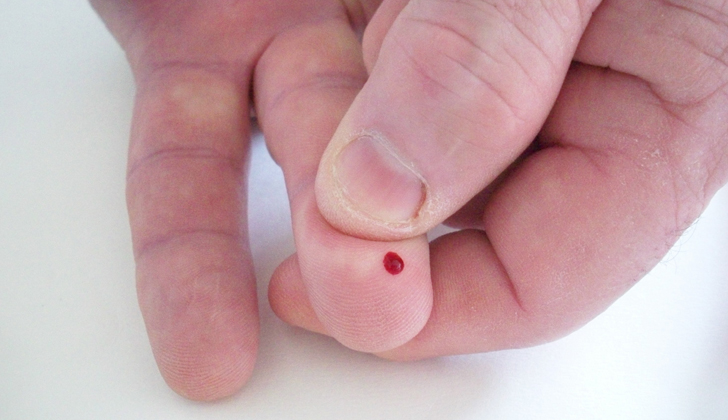prueba de sangre