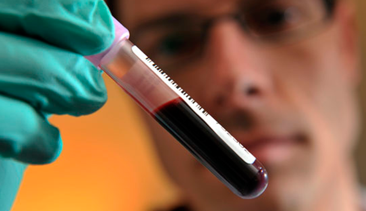 tipos-de-sangre-predicen-enfermedades