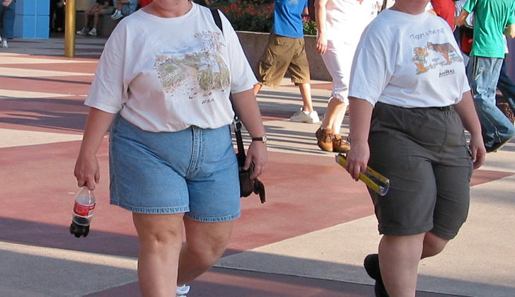Resultado de imagen para obesidad en las calles