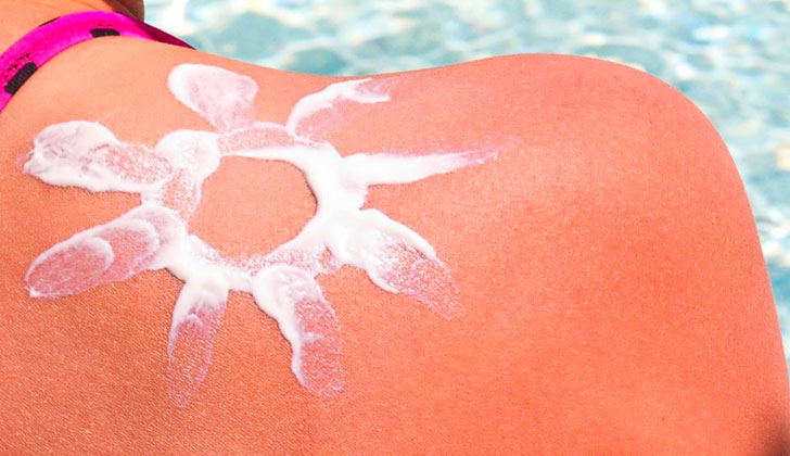Dermatólogos advierten sobre los peligros de la nueva tendencia "Sunburn art" que busca crear diseños en el cuerpo a través de la exposición al sol. Foto: Getty Images