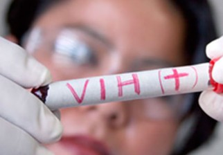 Científicos encuentran forma de “adormecer” el VIH. Foto: EFE