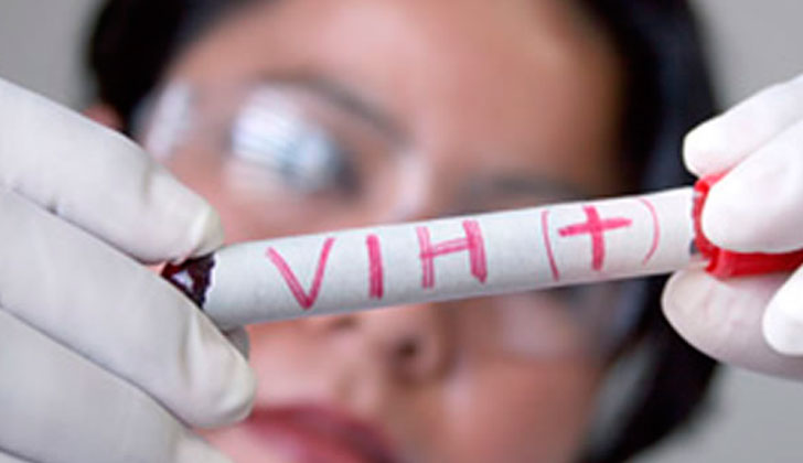 Científicos encuentran forma de “adormecer” el VIH. Foto: EFE