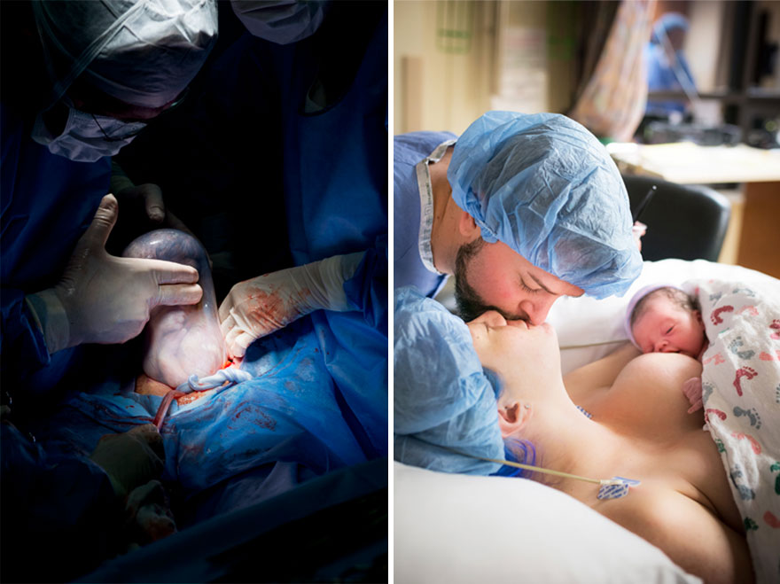 professional-birth-photography-competition-winners-labor-delivery-postpartum-161
