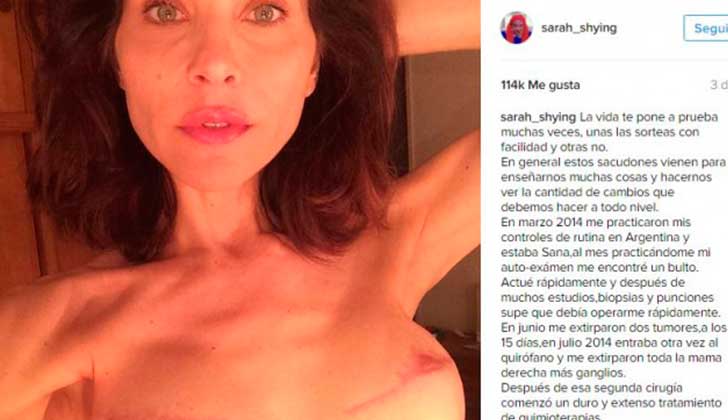 Actriz argentina publicó una emotiva carta para concientizar sobre el cáncer.