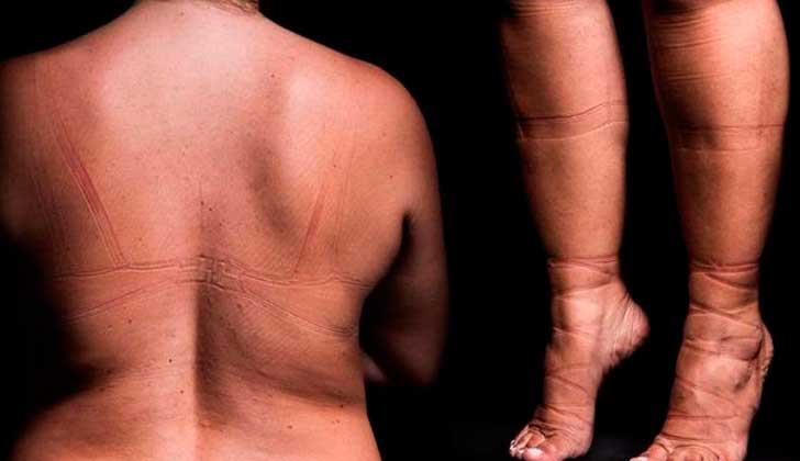 Campaña brasileña muestra las marcas que deja en la piel "ser esclava de la moda".