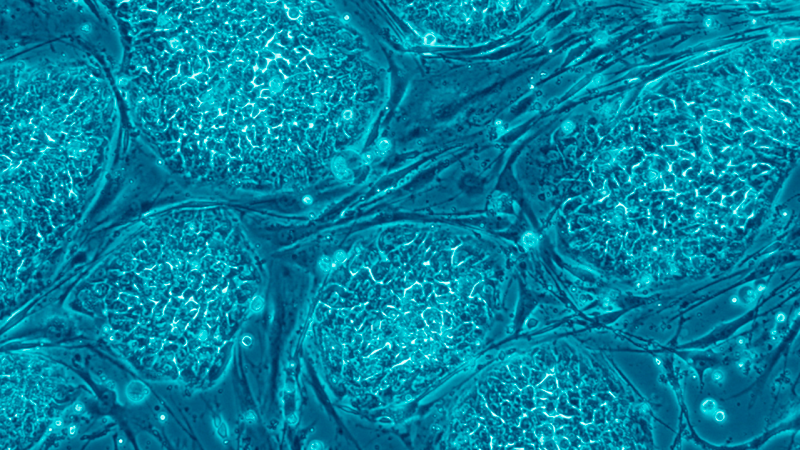Células madre embrionarias de un ser humano. Foto: Wikimedia Commons