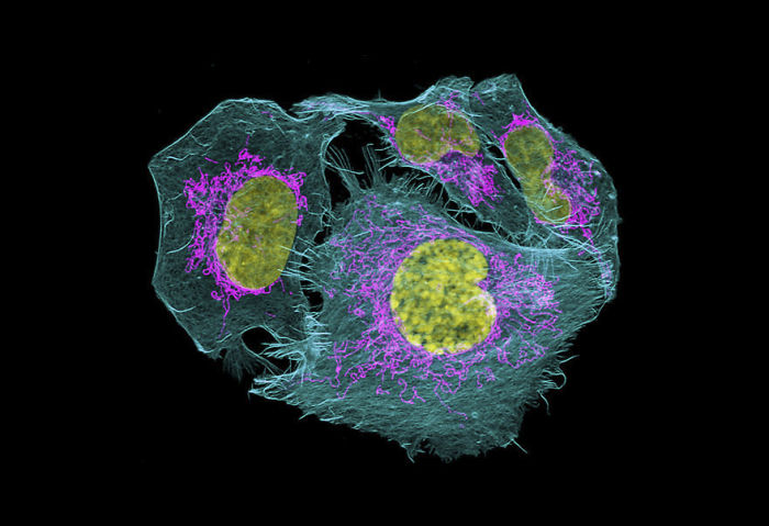 Células de cáncer de próstata, EEUU, imagen distinguida