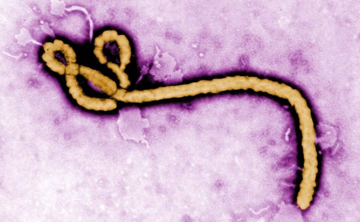 Virión del virus del ébola. Foto: CDC 