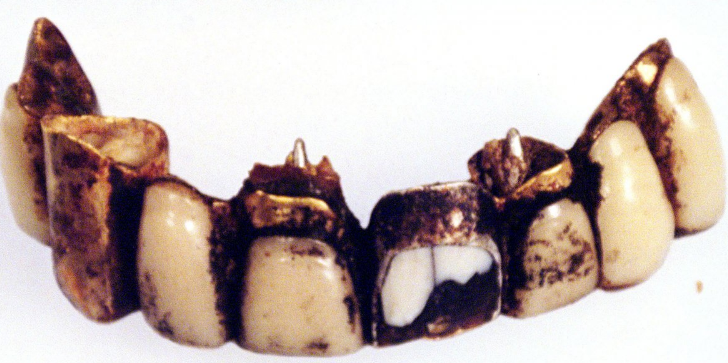 hitler dientes