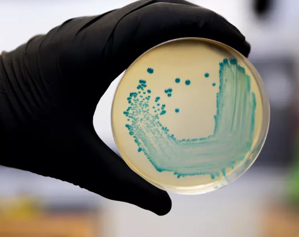 Bacteria Listeria aislada de una fuente alimenticia. Foto: Shuterstock