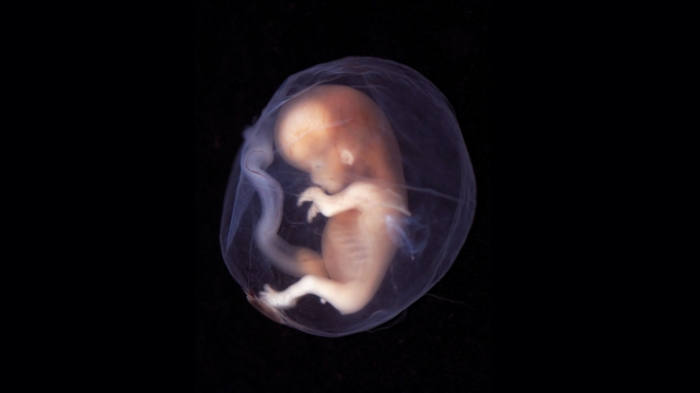 Embrión de 9 a 10 semanas de gestación