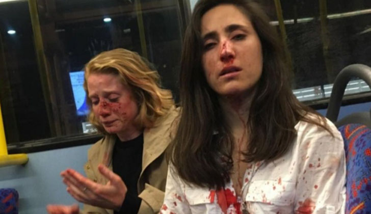 Melania Geymonat y su novia Chris agredidas en una autobús en Londres.