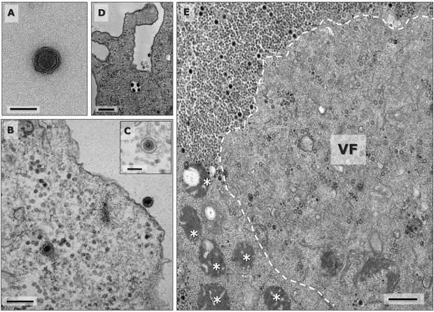 Imágenes de microscopio electrónico del Yaravirus 