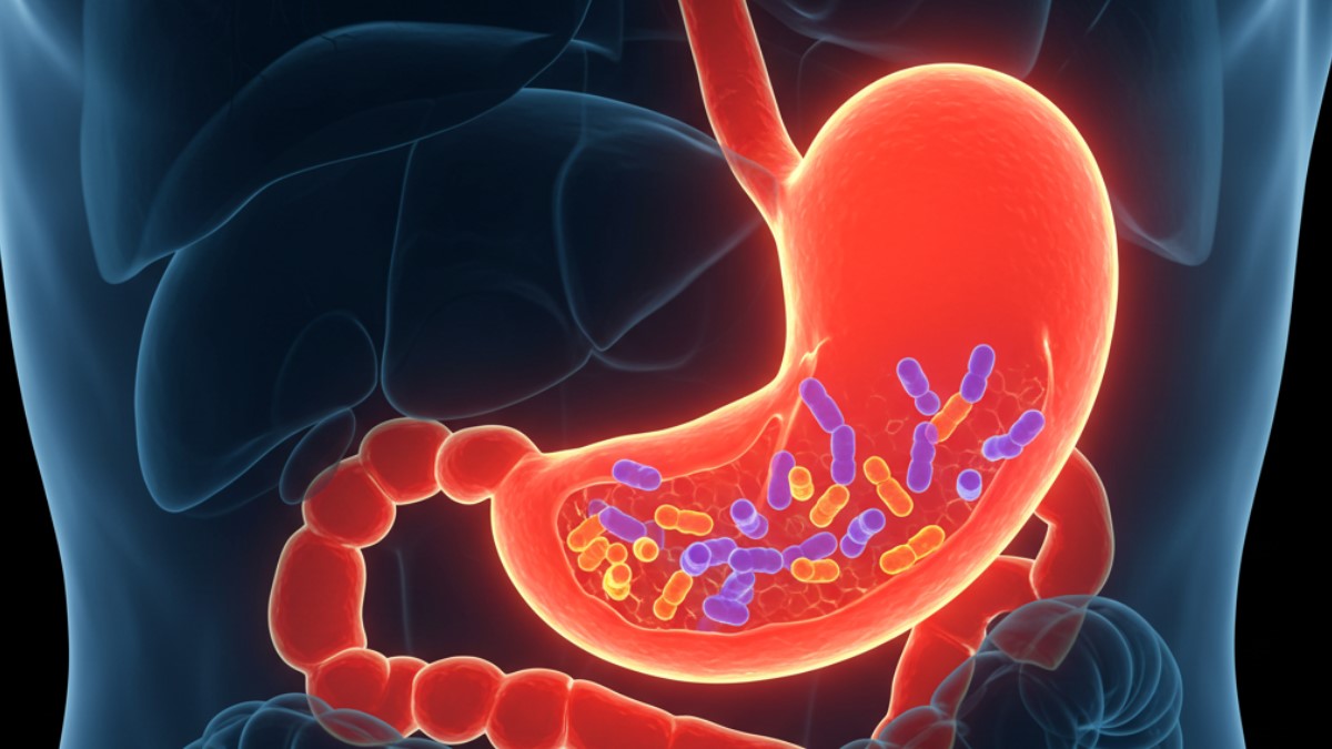 Úlceras y cáncer de estómago: los riesgos del Helicobacter pylori que no puedes ignorar.