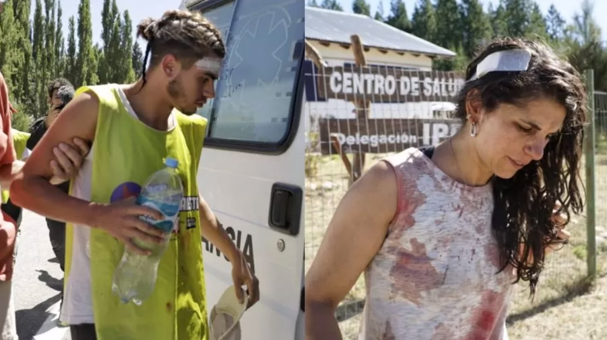 La actual Diputada de CABA, Buenos Aires, Argentina, electa por el FIT-Unidad - MST. En aquel momento 2 de febrero del 2023, cuando fue herida en la cabeza por los baqueanos de Lewis.