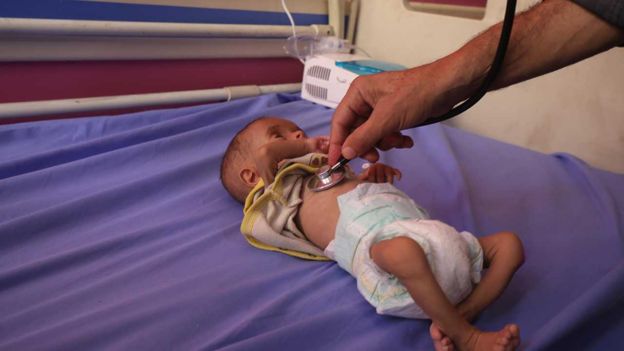 El asedio israelí está provocando una severa hambruna en Gaza, y el mundo presiona para que deje entrar alimentos.