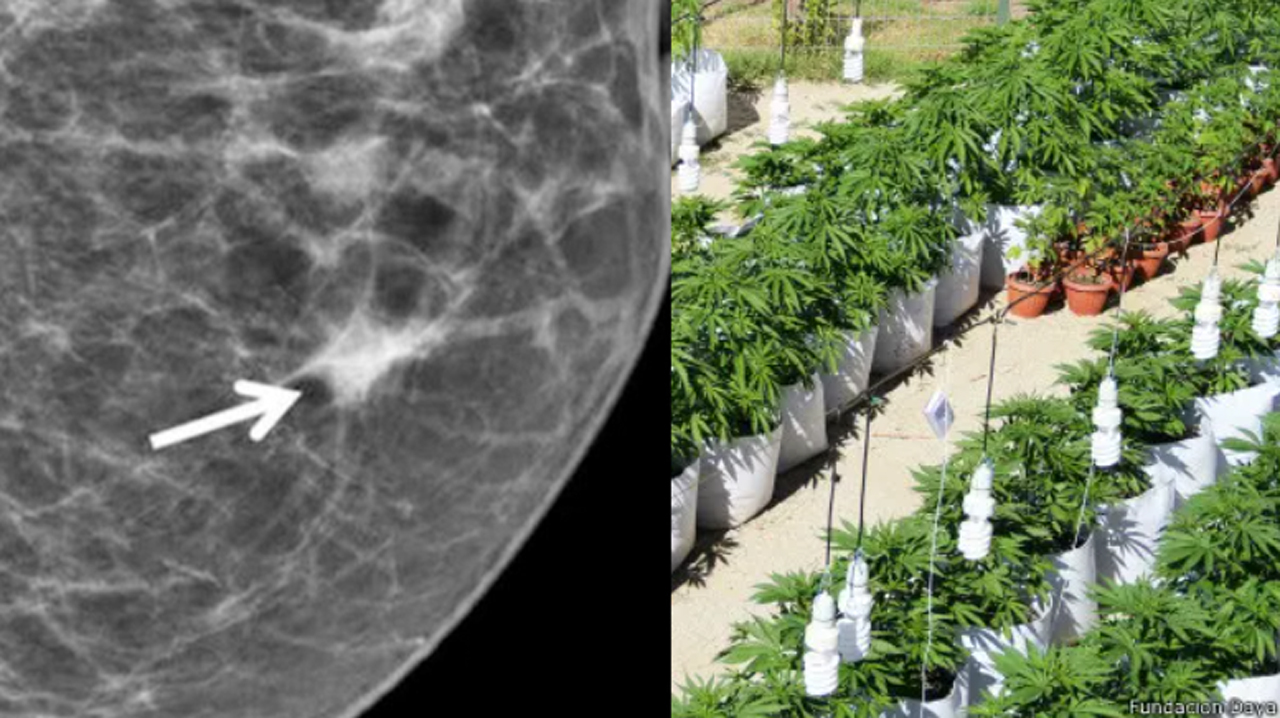 A la izquierda, una mamografía muestra la presencia del cáncer. A la derecha, un vivero de marihuana que contiene cannabinoides.