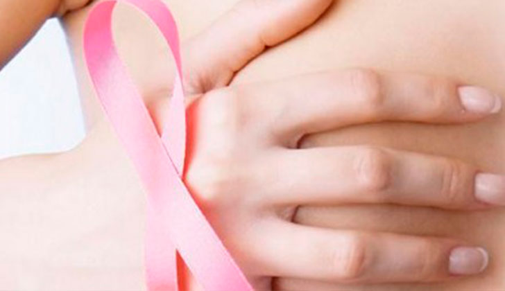 En México desarrollaron un nanobiosensor para detectar el cáncer de mama de forma temprana. Foto: EFE