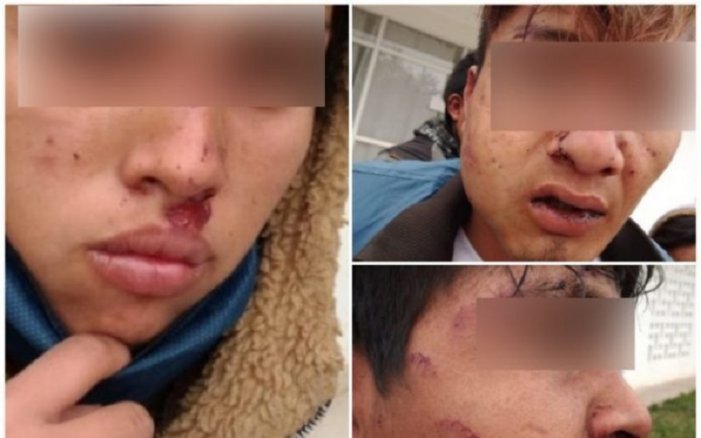 Jóvenes agredidos por la policía en Chaco, Argentina.