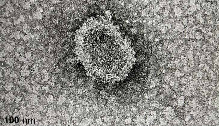 Primeras imágenes tomadas al virus SARS-COV2 a partir de muestras de pacientes uruguayos, en el CURE de Rocha, con microscopio electrónico. 
