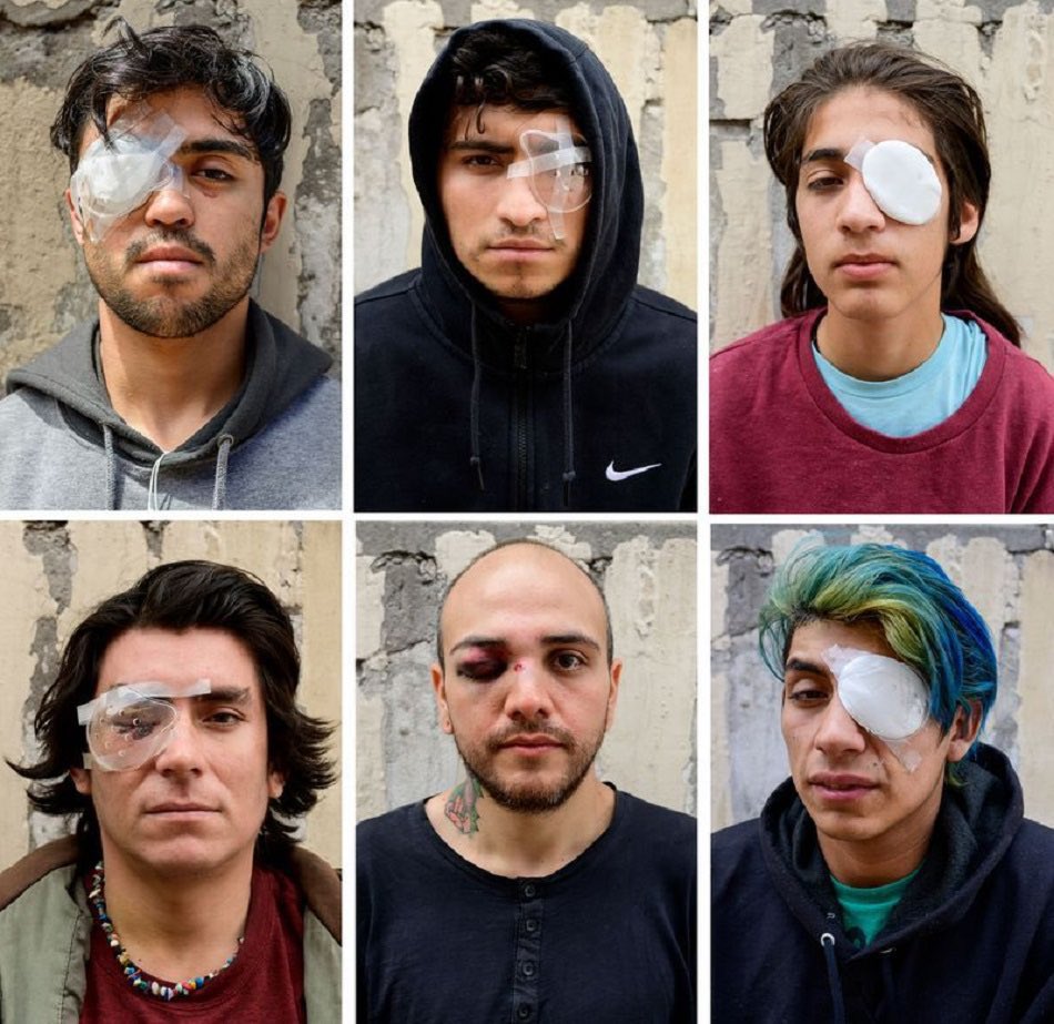 Organizaciones civiles chilenas estiman que más de 400 jóvenes perdieron un ojo o la vista completamente a manos de policías o militares durante las protestas de hace dos años. 