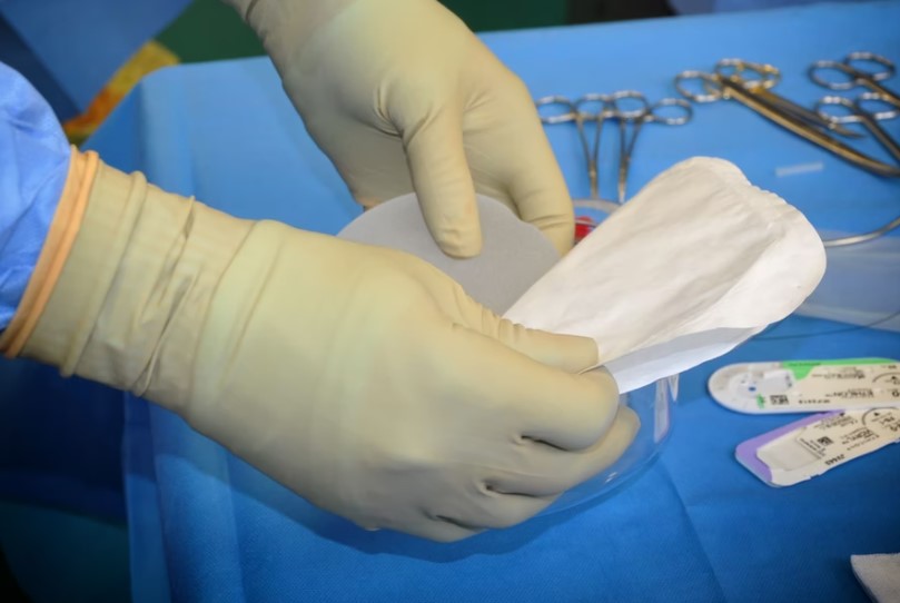 Un médico prepara un implante mamario para una mastectomía. Foto: UNsplash / Philippe Spitalier